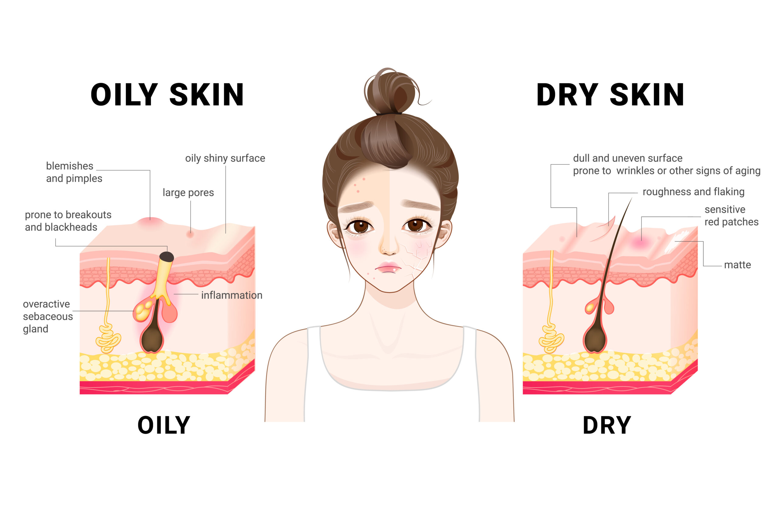 oily vs dry skin